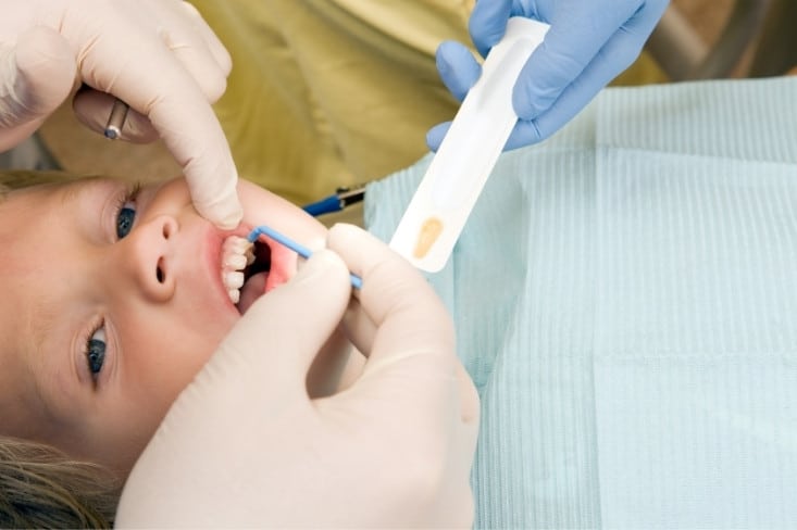 why pediatric fluoride treatments are essential